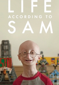 La Vita con la Progeria (2013)